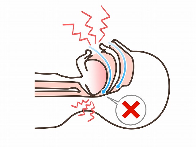閉塞性の睡眠時無呼吸症候群